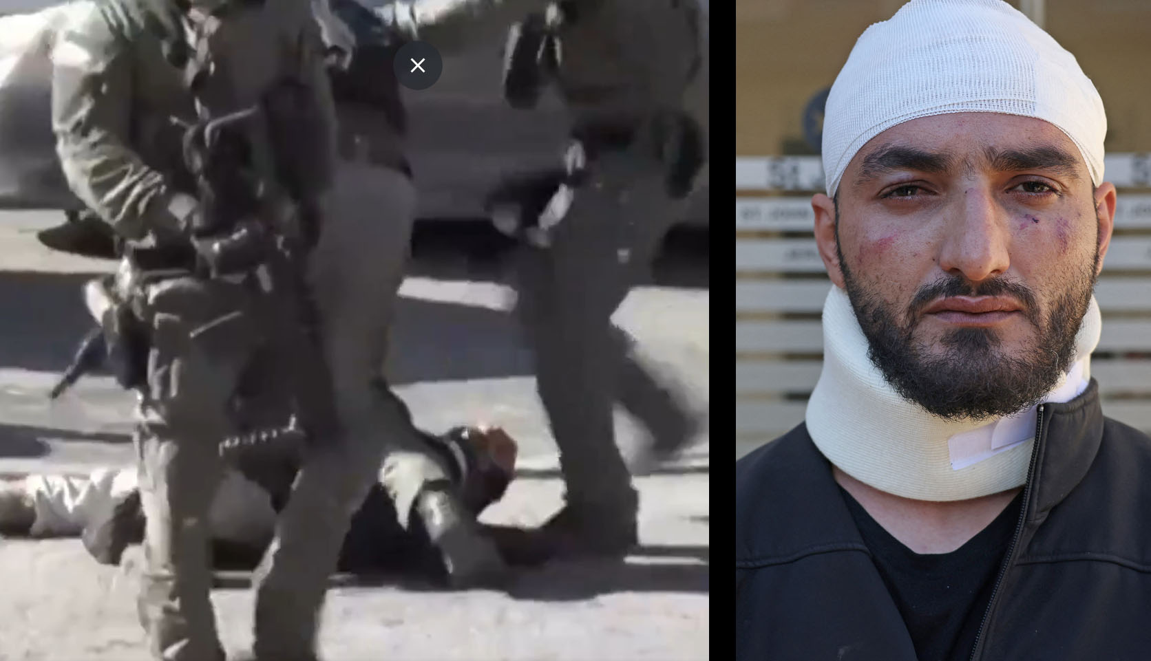 US disturbed by Israeli police beating of Turkish photographer