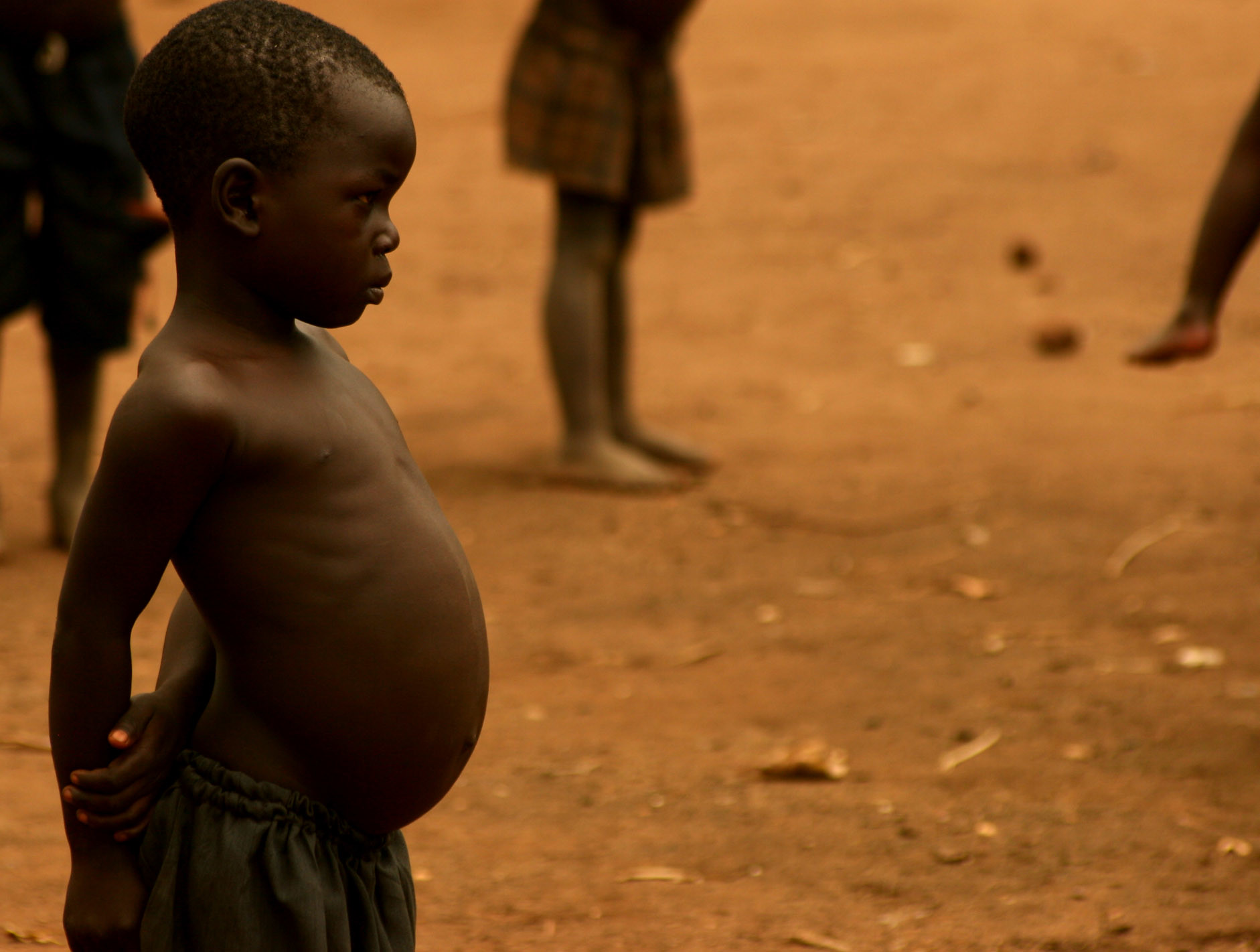 Sudan on brink of catastrophe, MSF warns of inadequate response