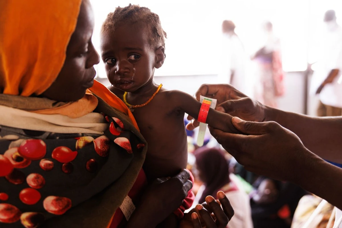 UNICEF Malnutrition Soaring Among Children In Africa UNICEF Malnutrition Soaring Among Children In Africa
