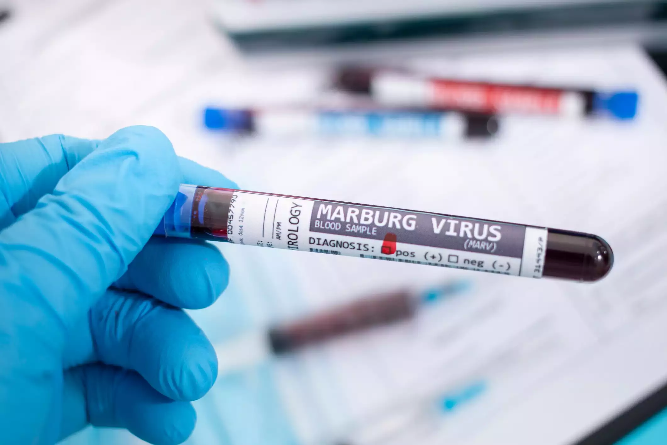 Rwanda declares end to Marburg virus outbreak
