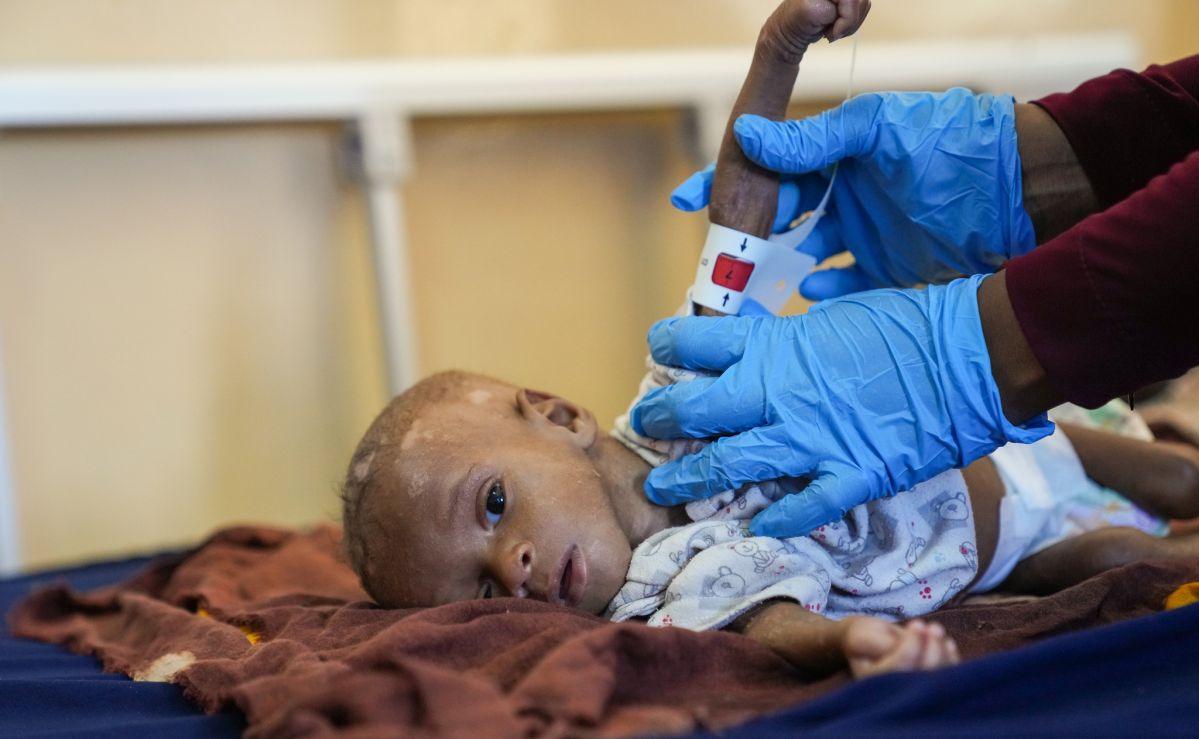 UNICEF warns child malnutrition aid in Ethiopia, Nigeria may stop
