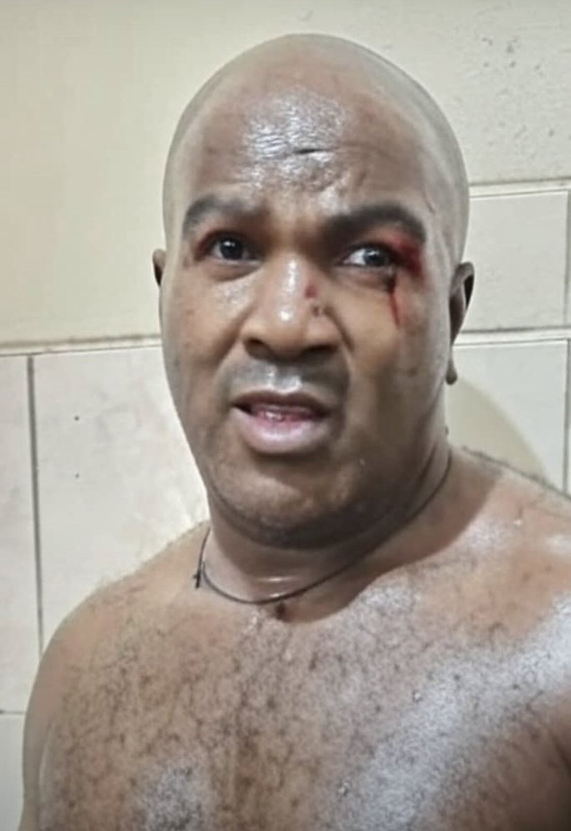 Uganda opposition activist charged after abduction, torture
