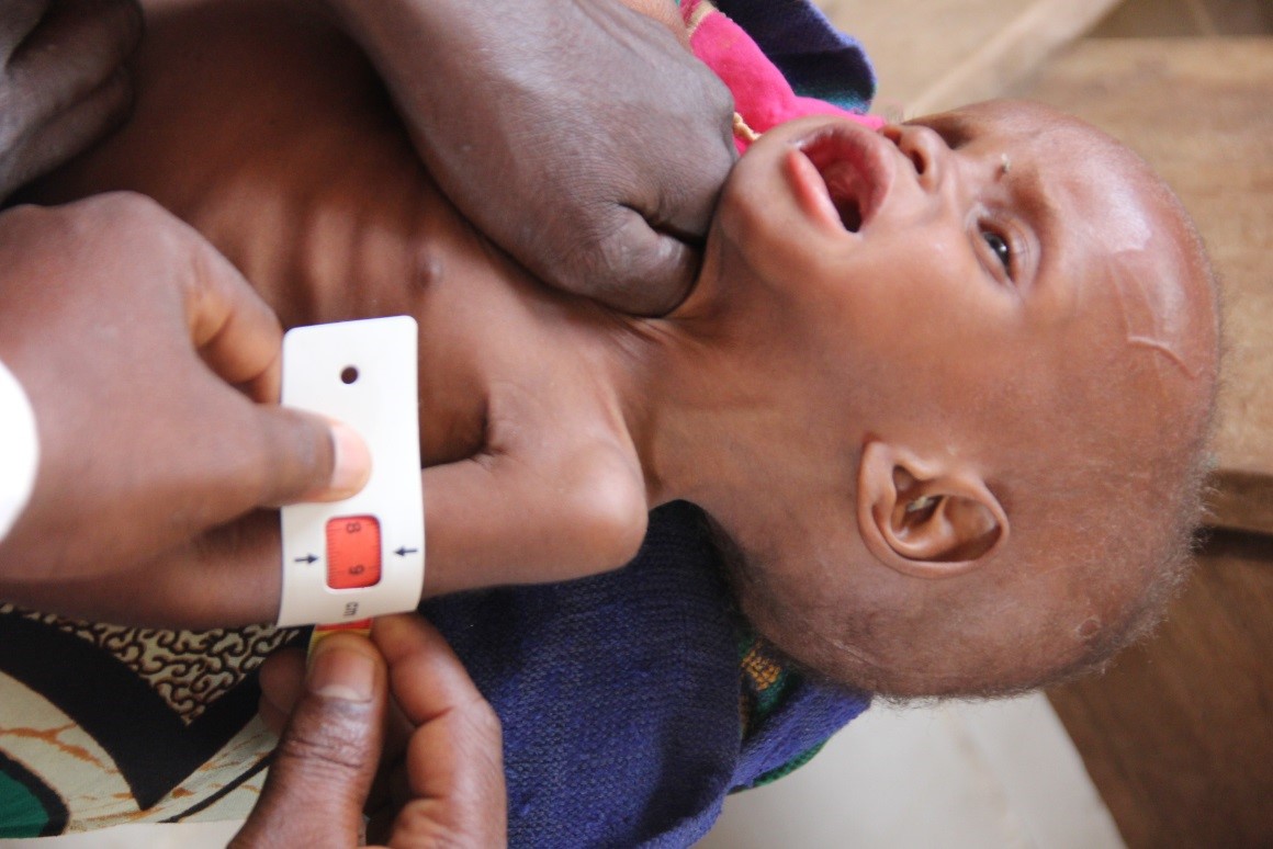 Over 600 malnourished children die in Nigeria amid aid collapse