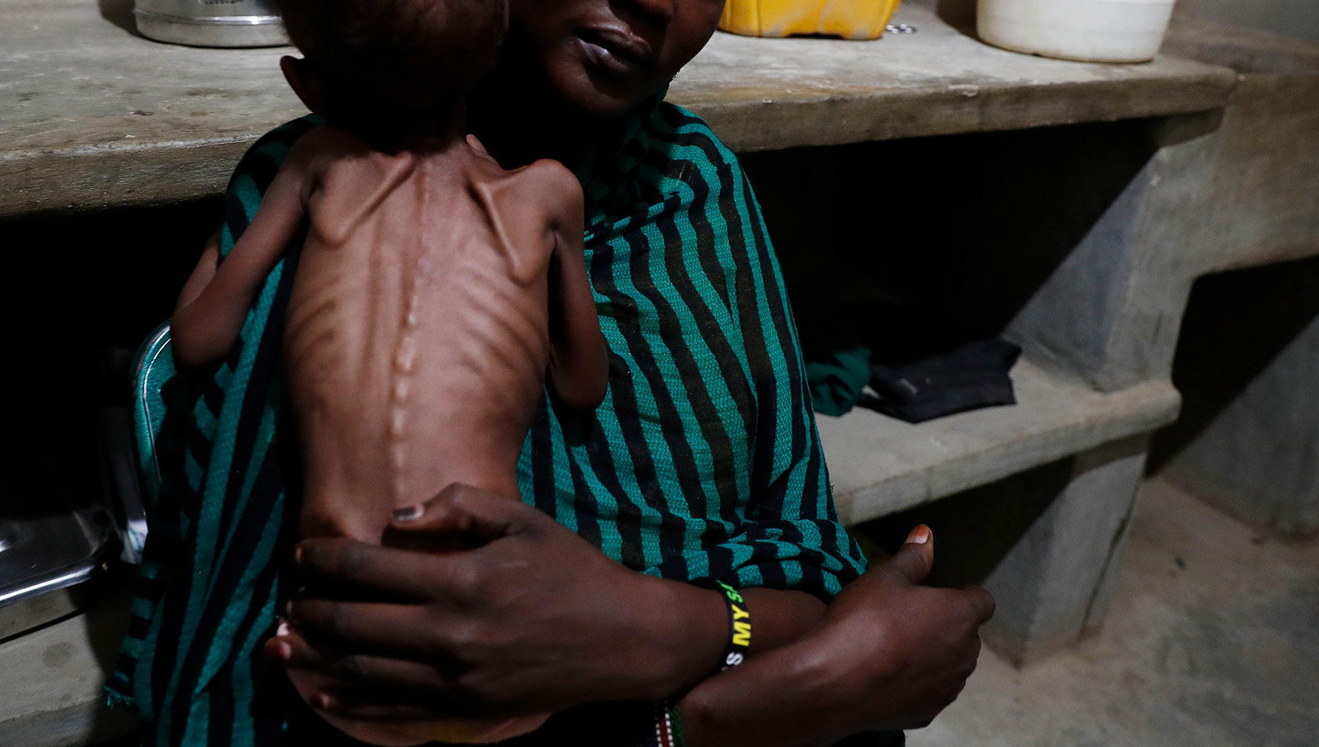 Funding cuts push Sudanese children toward irreversible harm fast