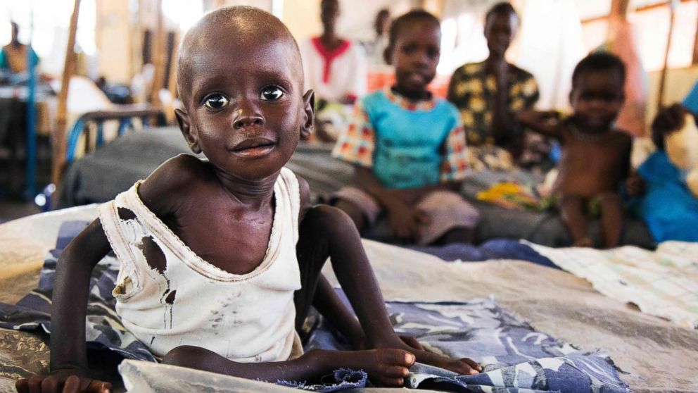 UN warns over worsening hunger crisis threatening South Sudan