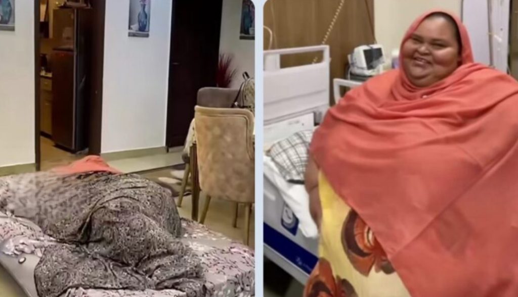 375kg Sudanese woman undergoes one of rarest obesity surgeries