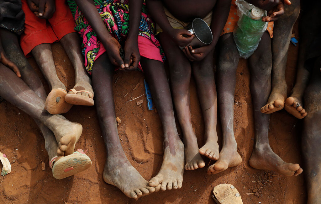 Severe disease outbreaks threaten 200K children in Sudan