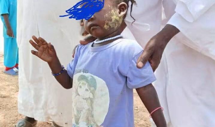 Unidentified rash affects dozens of children in North Darfur